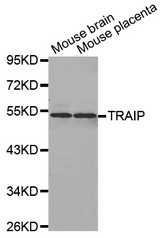 Western blot analysis of extracts of various cell lines, using TRAIP antibody.
