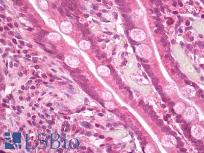 Anti-TRAIP / TRIP antibody IHC of human small intestine. Immunohistochemistry of formalin-fixed, paraffin-embedded tissue after heat-induced antigen retrieval. Antibody LS-B7778 dilution 10 ug/ml.