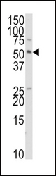 Western blot of anti-TRAIP Antibody in HepG2 cell line lysates (35 ug/lane). TRAIP(arrow) was detected using the purified antibody.
