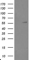 HEK293T cells were transfected with the pCMV6-ENTRY control (Left lane) or pCMV6-ENTRY TRAIP (Right lane) cDNA for 48 hrs and lysed. Equivalent amounts of cell lysates (5 ug per lane) were separated by SDS-PAGE and immunoblotted with anti-TRAIP.