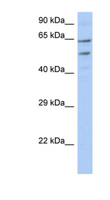 TMCC3 antibody LS-C111237 Western blot of OVCAR-3 cell lysate.