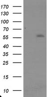 HEK293T cells were transfected with the pCMV6-ENTRY control (Left lane) or pCMV6-ENTRY TRAIP (Right lane) cDNA for 48 hrs and lysed. Equivalent amounts of cell lysates (5 ug per lane) were separated by SDS-PAGE and immunoblotted with anti-TRAIP.