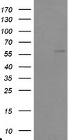 HEK293T cells were transfected with the pCMV6-ENTRY control (Left lane) or pCMV6-ENTRY TRAIP (Right lane) cDNA for 48 hrs and lysed. Equivalent amounts of cell lysates (5 ug per lane) were separated by SDS-PAGE and immunoblotted with anti-TRAIP.
