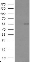 HEK293T cells were transfected with the pCMV6-ENTRY control (Left lane) or pCMV6-ENTRY TRAIP (Right lane) cDNA for 48 hrs and lysed. Equivalent amounts of cell lysates (5 ug per lane) were separated by SDS-PAGE and immunoblotted with anti-TRAIP.