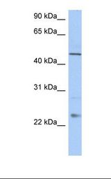 Fetal liver lysate. Antibody concentration: 1.0 ug/ml. Gel concentration: 12%.