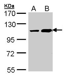 Sample (30 ug of whole cell lysate). A: Hep G2 , B: Molt-4 . 7.5% SDS PAGE. TRAK2 antibody diluted at 1:1000