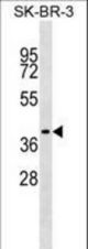 TRAM1 Antibody western blot of SK-BR-3 cell line lysates (35 ug/lane). The TRAM1 antibody detected the TRAM1 protein (arrow).