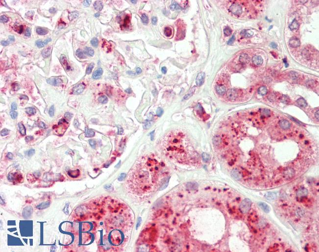 Anti-TRAM1 antibody IHC staining of human kidney. Immunohistochemistry of formalin-fixed, paraffin-embedded tissue after heat-induced antigen retrieval. Antibody LS-B10961 dilution 1:100.