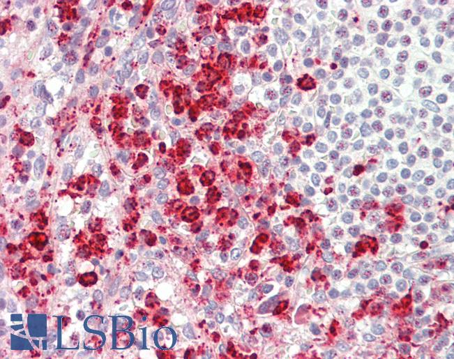Anti-TRAM1 antibody IHC staining of human spleen. Immunohistochemistry of formalin-fixed, paraffin-embedded tissue after heat-induced antigen retrieval.