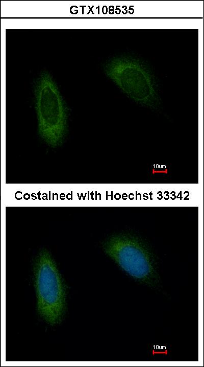 Immunofluorescence of methanol-fixed HeLa using TRAM1 antibody at 1:500 dilution.
