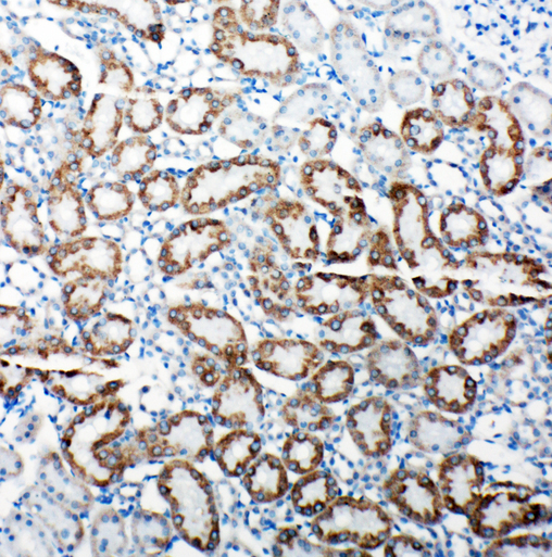 TRAM1 antibody. IHC(P): Rat Kidney Tissue.