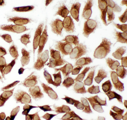 TRAM1 antibody. ICC: HELA Cell.