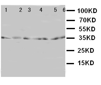 WB of TRAM1 antibody. Lane 1: Rat Brain Tissue Lysate. Lane 2: Rat Kidney Tissue Lysate. Lane 3: 293T Cell Lysate. Lane 4: RAJI Cell Lysate. Lane 5: JURKAT Cell Lysate.