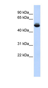 TRAM1L1 antibody LS-C102496 Western blot of Fetal liver lysate.