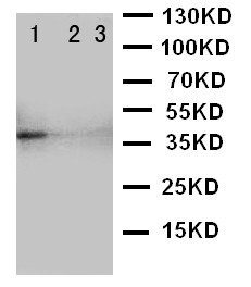 WB of TRAM2 antibody. Recombinant Protein Detection Source:. E.coli derived -recombinant Mouse TRAM2,39.0KD. (162aa tag+R190-P370). Lane 1: Recombinant Mouse TRAM2 Protein 10ng. Lane 2: Recombinant Mouse TRAM2 Protein 5ng. Lane 3: Recombinant Mouse TRAM2 Protein 2.5ng.