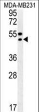 TRAM2 Antibody western blot of MDA-MB231 cell line lysates (35 ug/lane). The TRAM2 antibody detected the TRAM2 protein (arrow).