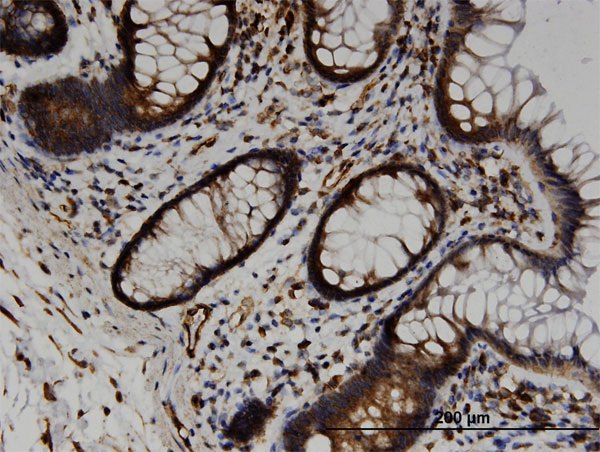 Immunoperoxidase of monoclonal antibody to TRAM2 on formalin-fixed paraffin-embedded human colon. [antibody concentration 3 ug/ml]