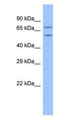 TRAP1 / HSP75 antibody Western Blot of HeLa.