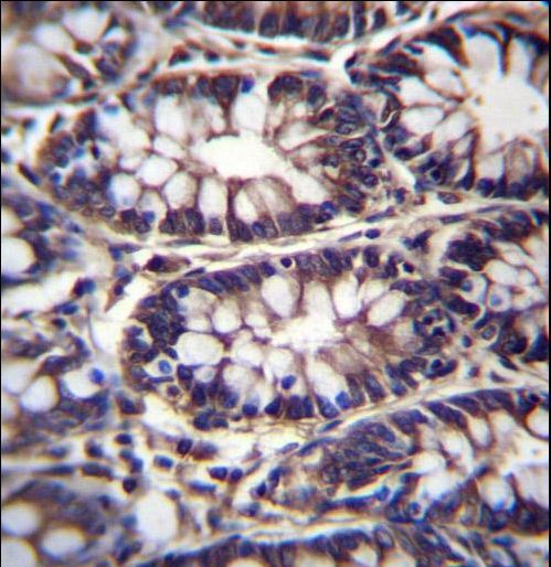 TTC15 Antibody immunohistochemistry of formalin-fixed and paraffin-embedded human rectum tissue followed by peroxidase-conjugated secondary antibody and DAB staining.