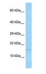TRAPPC2 / SEDL antibody Western Blot of Trappc2 antibodies. Sample Tissue: Rat Stomach lysates. Antibody Dilution: 1.0 ug/ml..