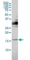 TRAPPC2 monoclonal antibody (M01), clone 2E10 Western Blot analysis of TRAPPC2 expression in HeLa.
