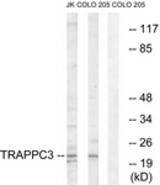 Western blot of extracts from COLO/Jurkat cells, using TRAPPC3 Antibody. The lane on the right is treated with the synthesized peptide.