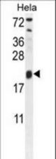 TRAPPC3 Antibody western blot of HeLa cell line lysates (35 ug/lane). The TRAPPC3 antibody detected the TRAPPC3 protein (arrow).