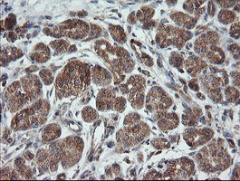 IHC of paraffin-embedded Human pancreas tissue using anti-TRAPPC4 mouse monoclonal antibody.