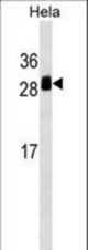 TMED1 Antibody western blot of HeLa cell line lysates (35 ug/lane). The TMED1 antibody detected the TMED1 protein (arrow).