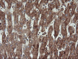 IHC of paraffin-embedded Human liver tissue using anti-TRAPPC4 mouse monoclonal antibody.