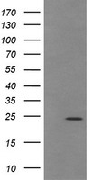 HEK293T cells were transfected with the pCMV6-ENTRY control (Left lane) or pCMV6-ENTRY TRAPPC4 (Right lane) cDNA for 48 hrs and lysed. Equivalent amounts of cell lysates (5 ug per lane) were separated by SDS-PAGE and immunoblotted with anti-TRAPPC4.