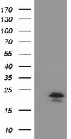 HEK293T cells were transfected with the pCMV6-ENTRY control (Left lane) or pCMV6-ENTRY TMED1 (Right lane) cDNA for 48 hrs and lysed. Equivalent amounts of cell lysates (5 ug per lane) were separated by SDS-PAGE and immunoblotted with anti-TMED1.