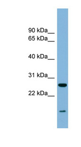 TRAPPC4 antibody LS-C107979 Western blot of Fetal Heart lysate.
