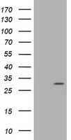 HEK293T cells were transfected with the pCMV6-ENTRY control (Left lane) or pCMV6-ENTRY TRAPPC4 (Right lane) cDNA for 48 hrs and lysed. Equivalent amounts of cell lysates (5 ug per lane) were separated by SDS-PAGE and immunoblotted with anti-TRAPPC4.