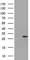 HEK293T cells were transfected with the pCMV6-ENTRY control (Left lane) or pCMV6-ENTRY TRAPPC4 (Right lane) cDNA for 48 hrs and lysed. Equivalent amounts of cell lysates (5 ug per lane) were separated by SDS-PAGE and immunoblotted with anti-TRAPPC4.