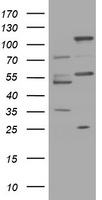 HEK293T cells were transfected with the pCMV6-ENTRY control (Left lane) or pCMV6-ENTRY TRAPPC4 (Right lane) cDNA for 48 hrs and lysed. Equivalent amounts of cell lysates (5 ug per lane) were separated by SDS-PAGE and immunoblotted with anti-TRAPPC4.