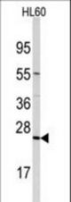 Western blot of anti-TRAPPC4 Antibody in HL60 cell line lysates (35 ug/lane). TRAPPC4 (arrow) was detected using the purified antibody.