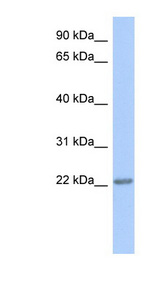 TRAPPC5 antibody LS-C111502 Western blot of HT1080 cell lysate.