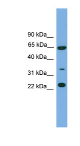 TRAPPC5 antibody LS-C116536 Western blot of HeLa lysate.