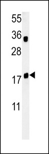 TPC6A Antibody western blot of Jurkat cell line lysates (35 ug/lane). The TPC6A antibody detected the TPC6A protein (arrow).