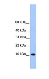 Hela cell lysate. Antibody concentration: 1.0 ug/ml. Gel concentration: 10%-20%.