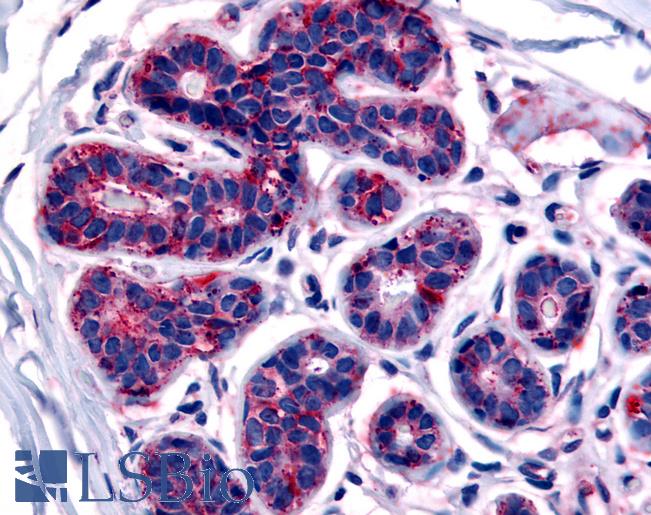 Anti-TRIB3 antibody LS-A2976 IHC of human breast. Immunohistochemistry of formalin-fixed, paraffin-embedded tissue after heat-induced antigen retrieval.