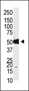 Western blot of anti-mDnmt2 antibody in HL-60 cell lysate. mDnmt2 (arrow) was detected using purified antibody. Secondary HRP-anti-rabbit was used for signal visualization with chemiluminescence.