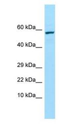 TREH antibody Western Blot of HeLa.