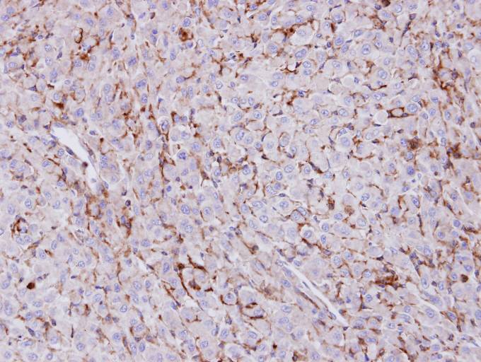 IHC of paraffin-embedded U87 xenograft using Trehalase antibody at 1:100 dilution.
