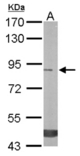 Sample (50 ug of whole cell lysate). A: mouse stomach. 7.5% SDS PAGE. TREH antibody diluted at 1:3000.