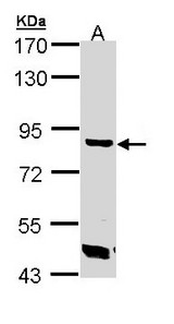 Sample (30 ug of whole cell lysate). A: A431 . 7.5% SDS PAGE. TREH antibody diluted at 1:1000