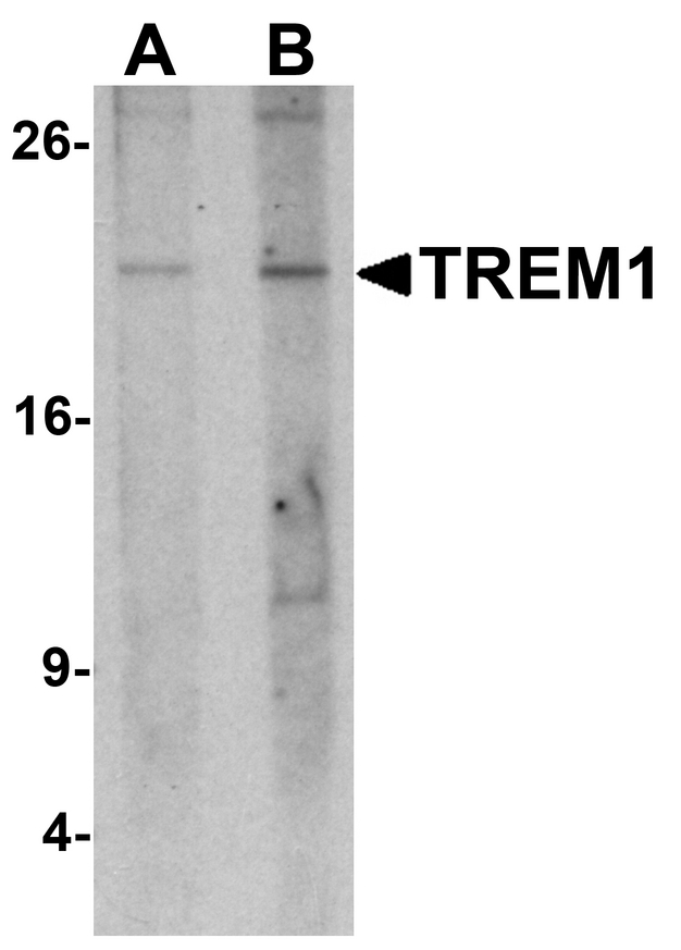 Western blot analysis of TREM1 in 293 cell lysate with TREM1 antibody at (A) 1 and (B) 2 ug/ml.