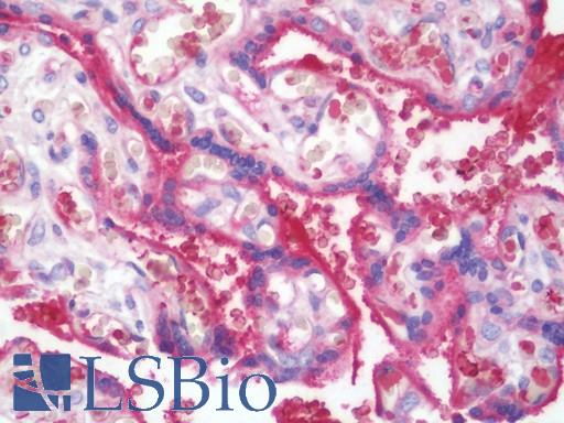 Anti-TREM1 antibody IHC staining of human placenta. Immunohistochemistry of formalin-fixed, paraffin-embedded tissue after heat-induced antigen retrieval. Antibody LS-B10694 dilution 1:100.