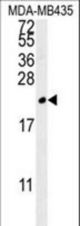 TREM2 Antibody western blot of MDA-MB435 cell line lysates (35 ug/lane). The TREM2 antibody detected the TREM2 protein (arrow).